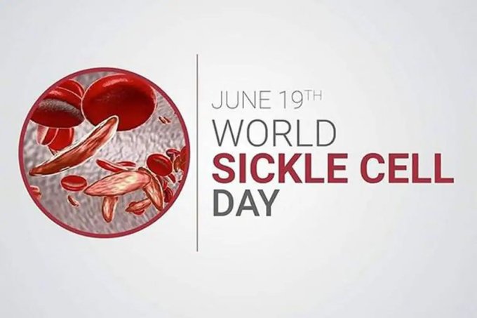 WORLD SICKLE CELL DAY Friday 19th June 2020- Safe Guiding Children Living With Sickle Cell Globally